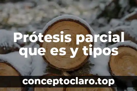 Prótesis parcial que es y tipos